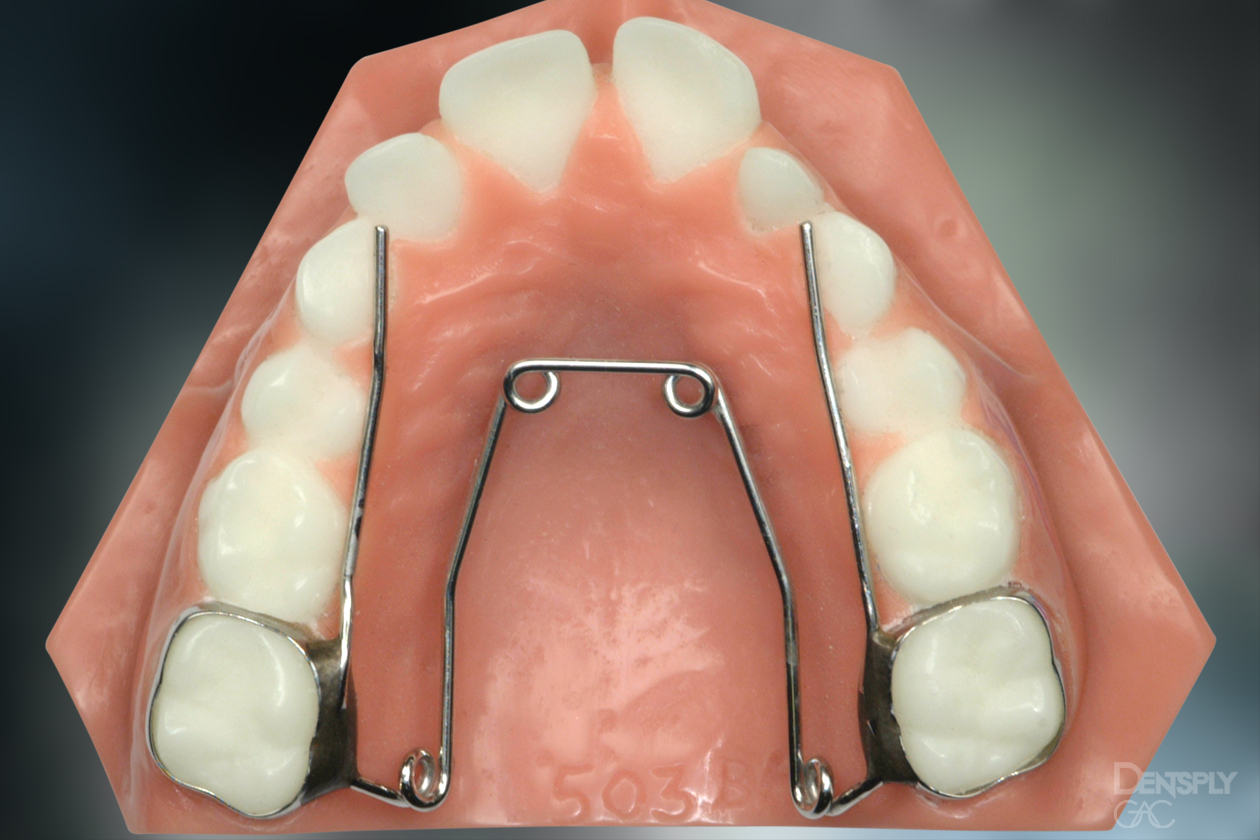 Demonstrates what a quadhelix looks like on a model of teeth.