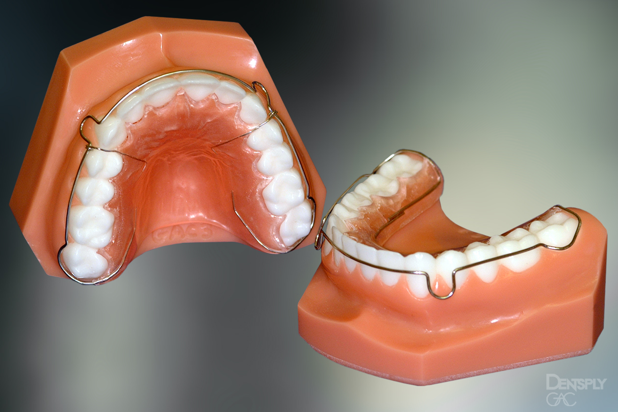 Капы после брекетов. Hawley ретейнер. Съемный ретейнер Каппа. Несъемные ретенционные аппараты.