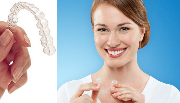 Invisalign